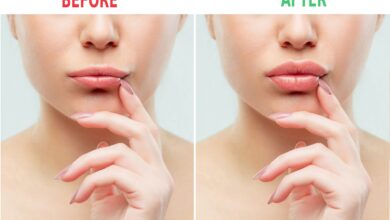 What is a lip flip​? Everything You Should Know