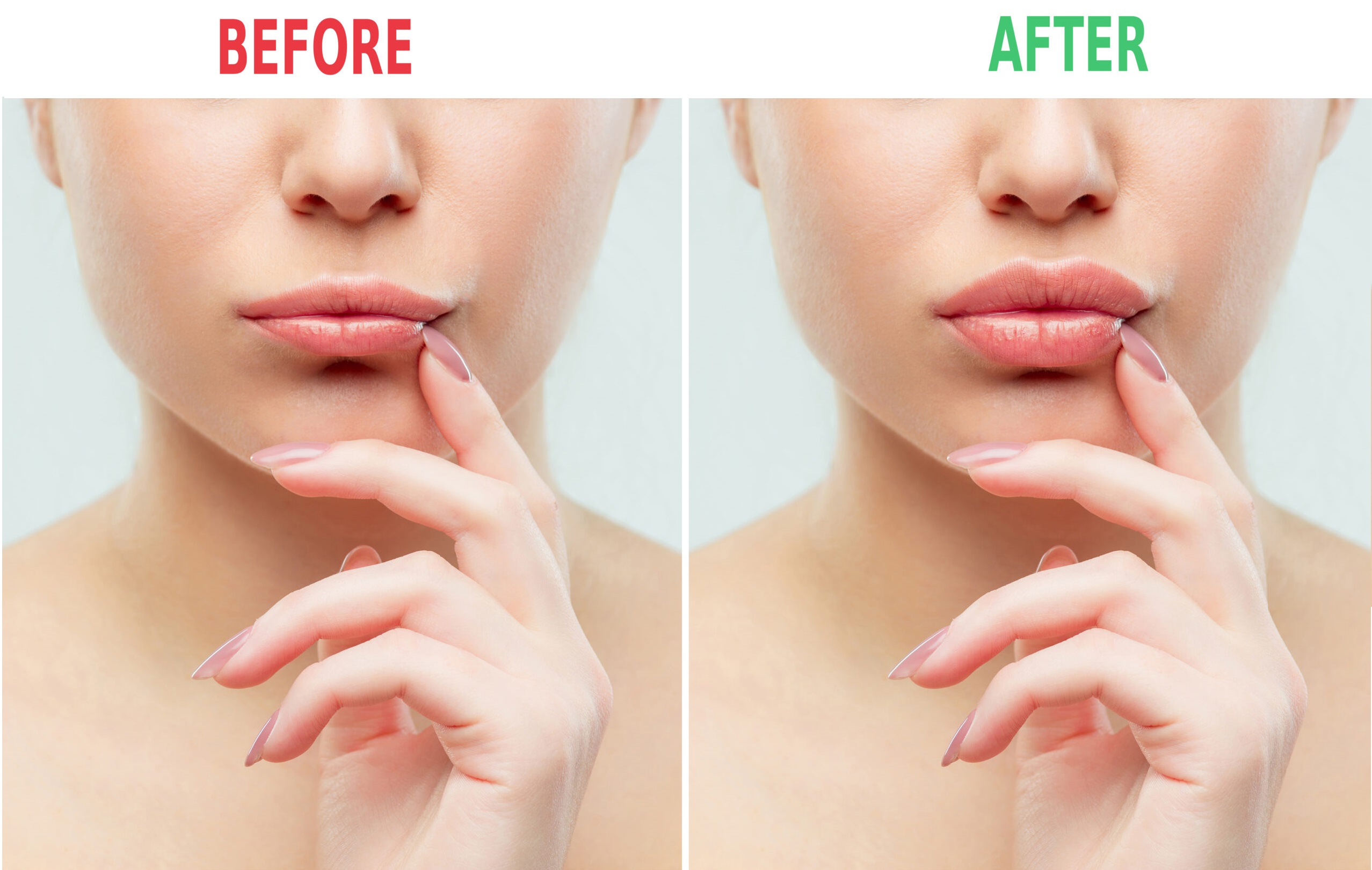 What is a lip flip​? Everything You Should Know